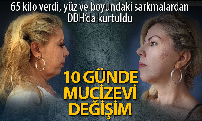 Nurgül Güldal’ın DDH’daki mucizevi değişimi