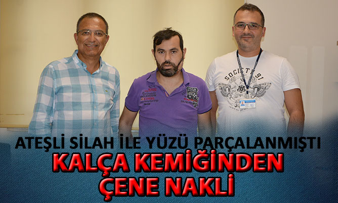 KALÇASINDAN ALINAN KEMİK YÜZÜNE NAKLEDİLDİ
