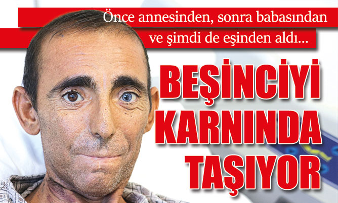 Önce annesinden, sonra babasından ve şimdi de eşinden böbrek aldı…