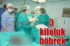 3 kiloluk böbrek