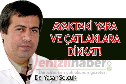AYAKTAKİ YARA VE ÇATLAKLARA DİKKAT!