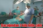 Bacağından 3 kilo kitle çıktı