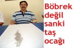 Böbrek değil sanki taş ocağı