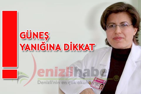 GÜNEŞ YANIĞINA DİKKAT!