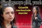 Güzelleşmeye gitti, yandı