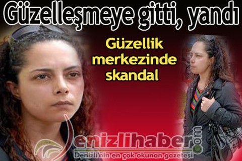 Güzelleşmeye gitti, yandı