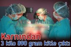 Karnından 3 kilo 890 gram kitle çıktı
