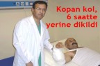Kopan kolu yerine diktiler!
