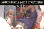 Polise bıçak çekti ayağından vuruldu