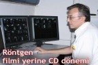 Röntgen filmi yerine CD dönemi
