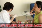 SÜT DİŞLERİNE FLOR VERNİK BAKIMI