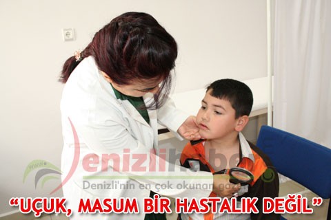 “UÇUK, MASUM BİR HASTALIK DEĞİL”