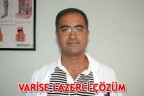 VARİSE LAZERLİ ÇÖZÜM