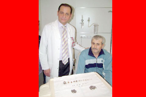 Böbrek değil sanki taş ocağı