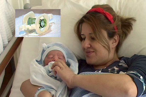 Özel Ege’de çan yöntemiyle sünnet