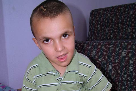 Denizli’de 7 yaşındaki Eren 14 ameliyat geçirdi