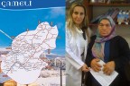 Çameli’nin amansız hastalığı Akromegali