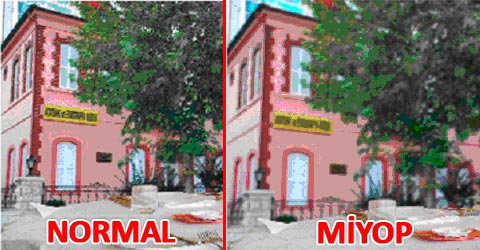 miyop