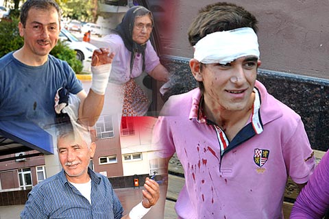 Acemi kasaplar hastanelik oldu