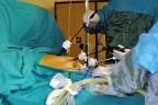TEKDEN HASTANESi’NDE LAPAROSKOPiK CERRAHİ