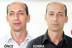 25 yıllık hastalığından 40 dakikada kurtuldu