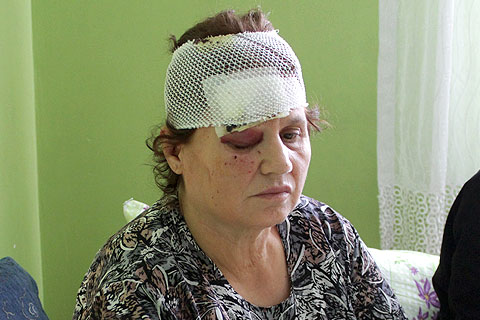 Trende başına parke taşı atıldı, ölümden döndü