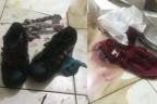 KISKANÇ EŞ GENÇ KIZIN ÜZERİNE ASİT DÖKTÜ