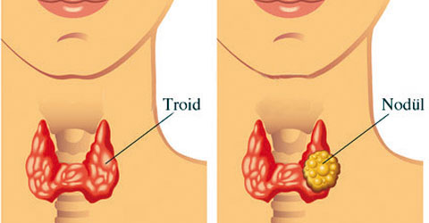 denizli-ozel-saglik-tiroid-ic-3