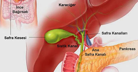 tekden-safra-kesesi-taslari-1