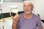 Hastanın mesanesinden 120 gram ağırlığında taş çıkarıldı