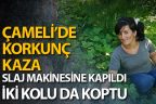 Genç kadın iki kolunu da slaj makinasına kaptırdı