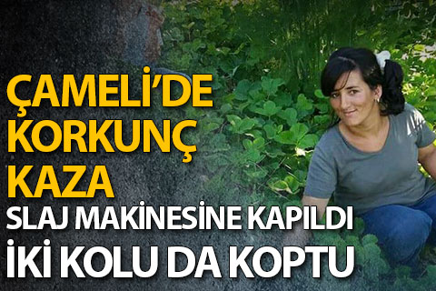 Genç kadın iki kolunu da slaj makinasına kaptırdı