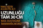 Hastanın böbreği ile mesanesi arasında 30 cm taş çıkarıldı