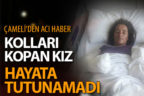 Slaj makinasında iki kolu kopan kız hayatını kaybetti