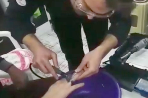 Parmağına sıkışan yüzüğü itfaiye çıkardı
