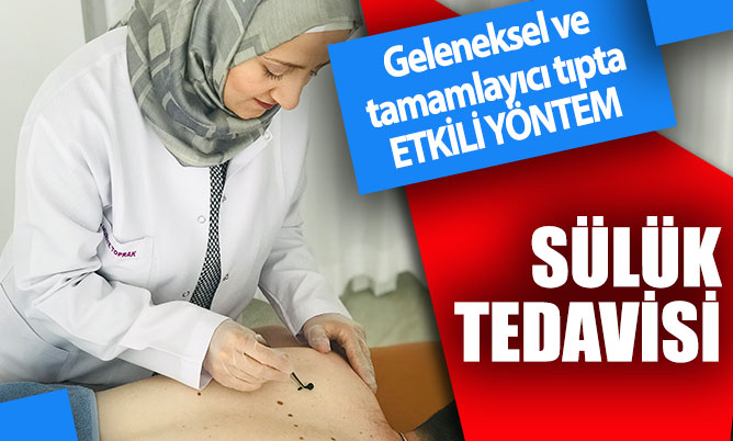 Geleneksel ve tamamlayıcı tıpta etkili yöntem: Sülük tedavisi