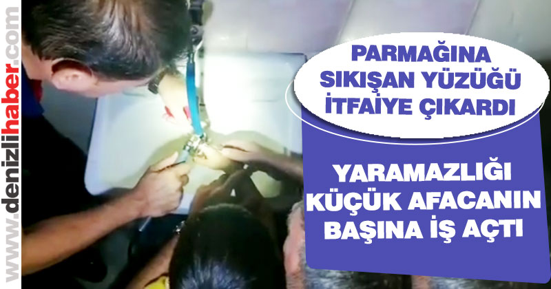 Parmağına sıkışan musluk yüzüğünü itfaiye çıkardı