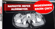 Midesinden eroin çıktı