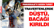 Pamukkale’de travertenlerden düşen turistin bacağı kırıldı