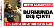 Burnundaki diş 6 yıl sonra çıkartıldı