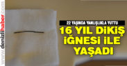 Yanlışlıkla yuttuğu dikiş iğnesi 16 yıl sonra çıkarıldı