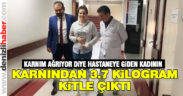 Kadının karnından devasa bir kitle çıktı