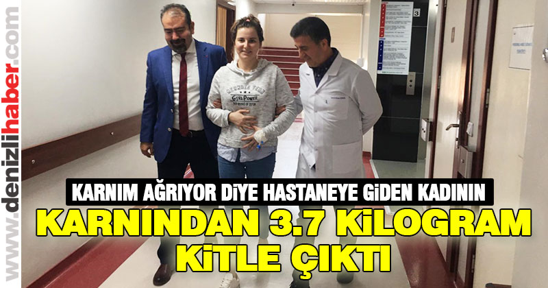 Kadının karnından devasa bir kitle çıktı