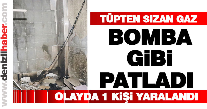 Tüpten sızan gazın patlaması sonucu 1 kişi yaralandı