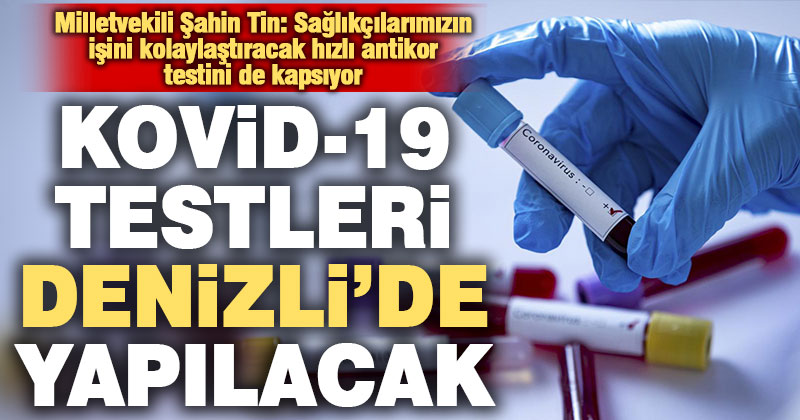 Kovid-19 testleri için Denizli’de laboratuvara yetkilendirme