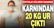 Egekent Hastanesi’nde genç kadının karnından 20 Kg. ur çıkarıldı