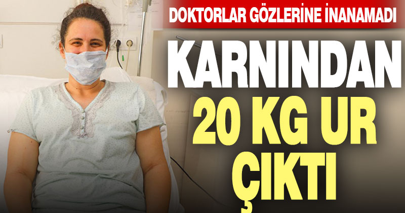 Egekent Hastanesi’nde genç kadının karnından 20 Kg. ur çıkarıldı
