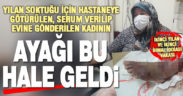 Yılan ısırması şikayetiyle, hastanede serum verilip evine gönderildiği iddia edilen kadın ölümden döndü
