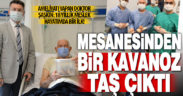 Mesane kanserini atlatan hastadan çıkan taşlar boyutuyla şaşırttı