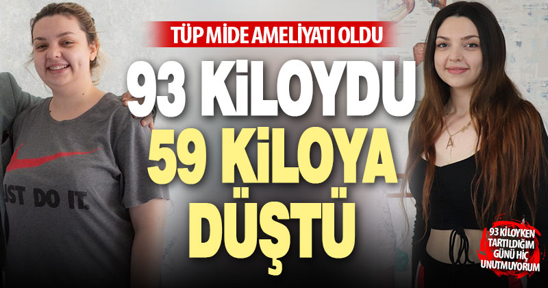 Tüp mide ameliyatı olan genç kız, 93 kilodan 59 kiloya düştü